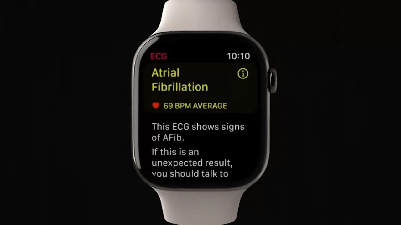 Triathlon runner credits Apple Watch for saving his life